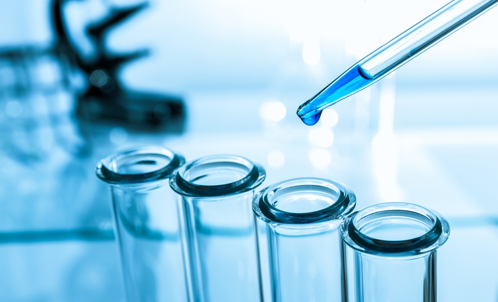 pipette and test tube on blue background pipette and test tube on blue background